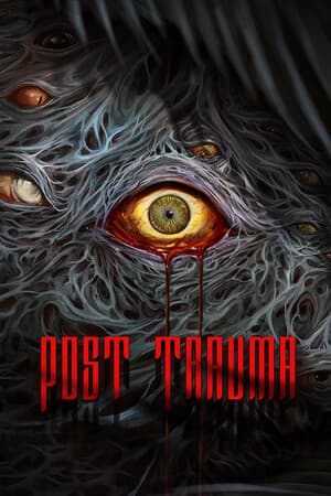 Post Trauma